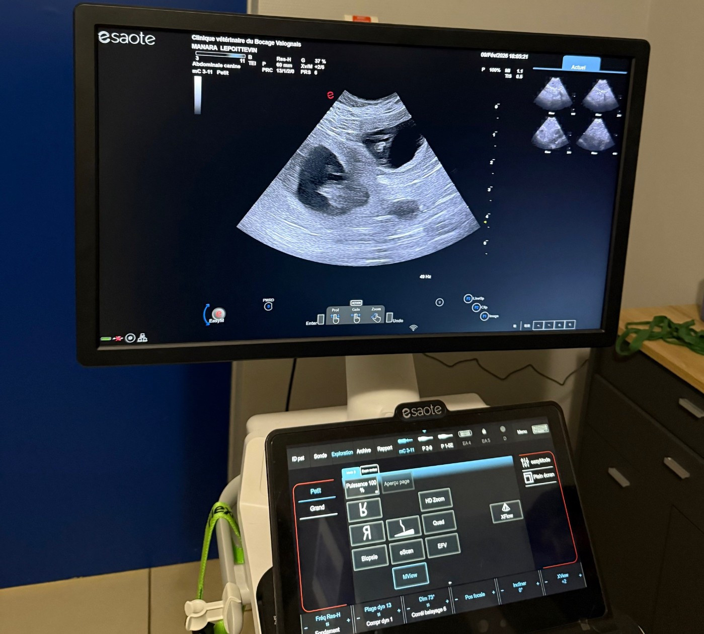 🔥 Confirmation de gestation SAMBA dBdB 🔥